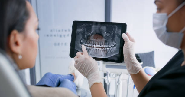 Licensed Wisdom Tooth Removal service in Hampton, IA - Smile Center Dentistry